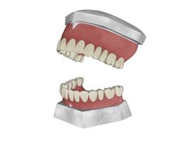 牙科口腔假牙SU模型