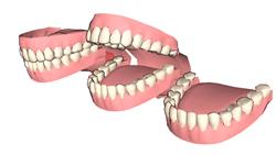 牙齿假牙SU模型