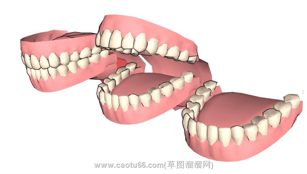 牙齿假牙SU模型 1